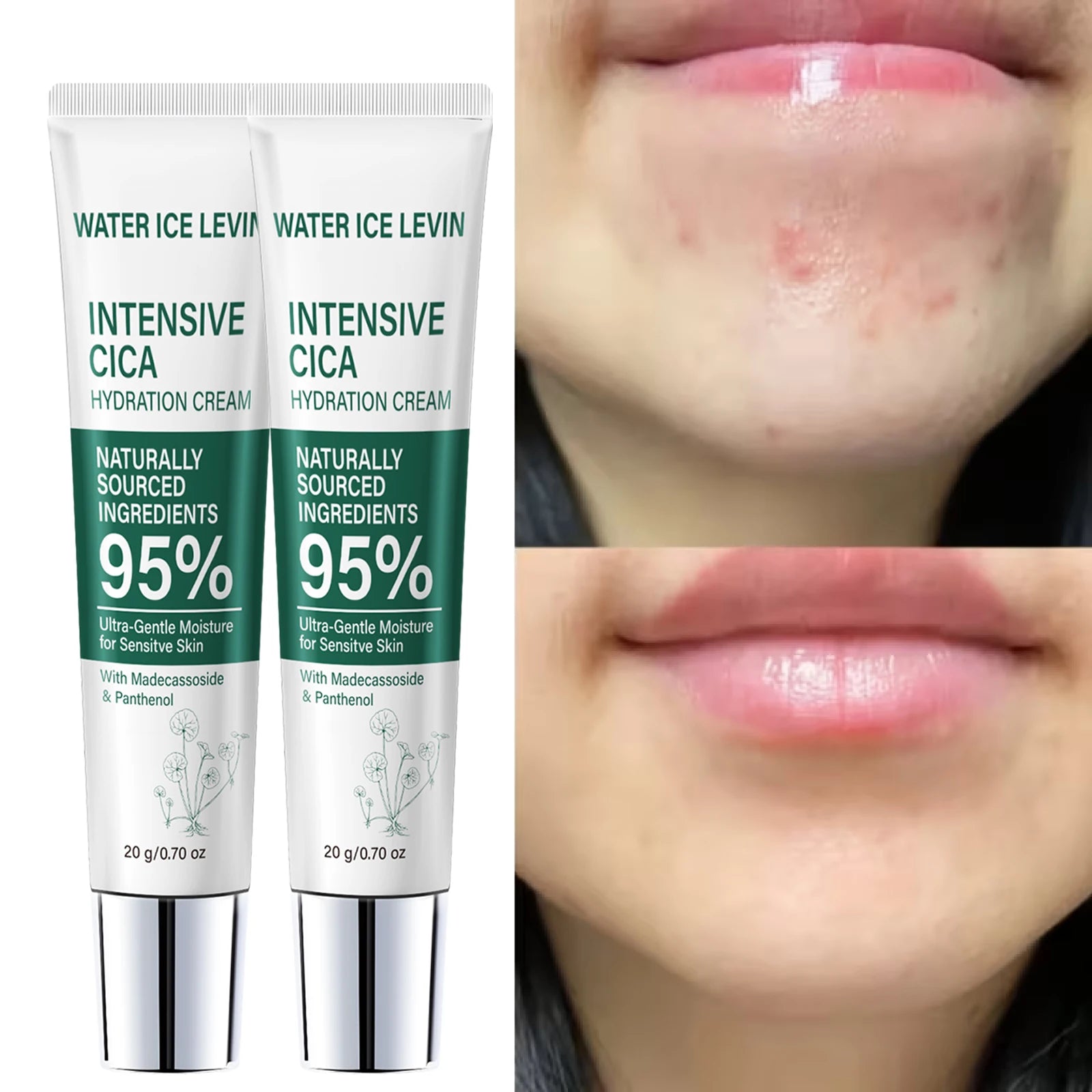 95% Natural Derived Cica Repair Lotion Madecassoside Panthenol Ultra Gentle Deep Hydration Soothe Sensitive Dry Skin Cream 20g Qme