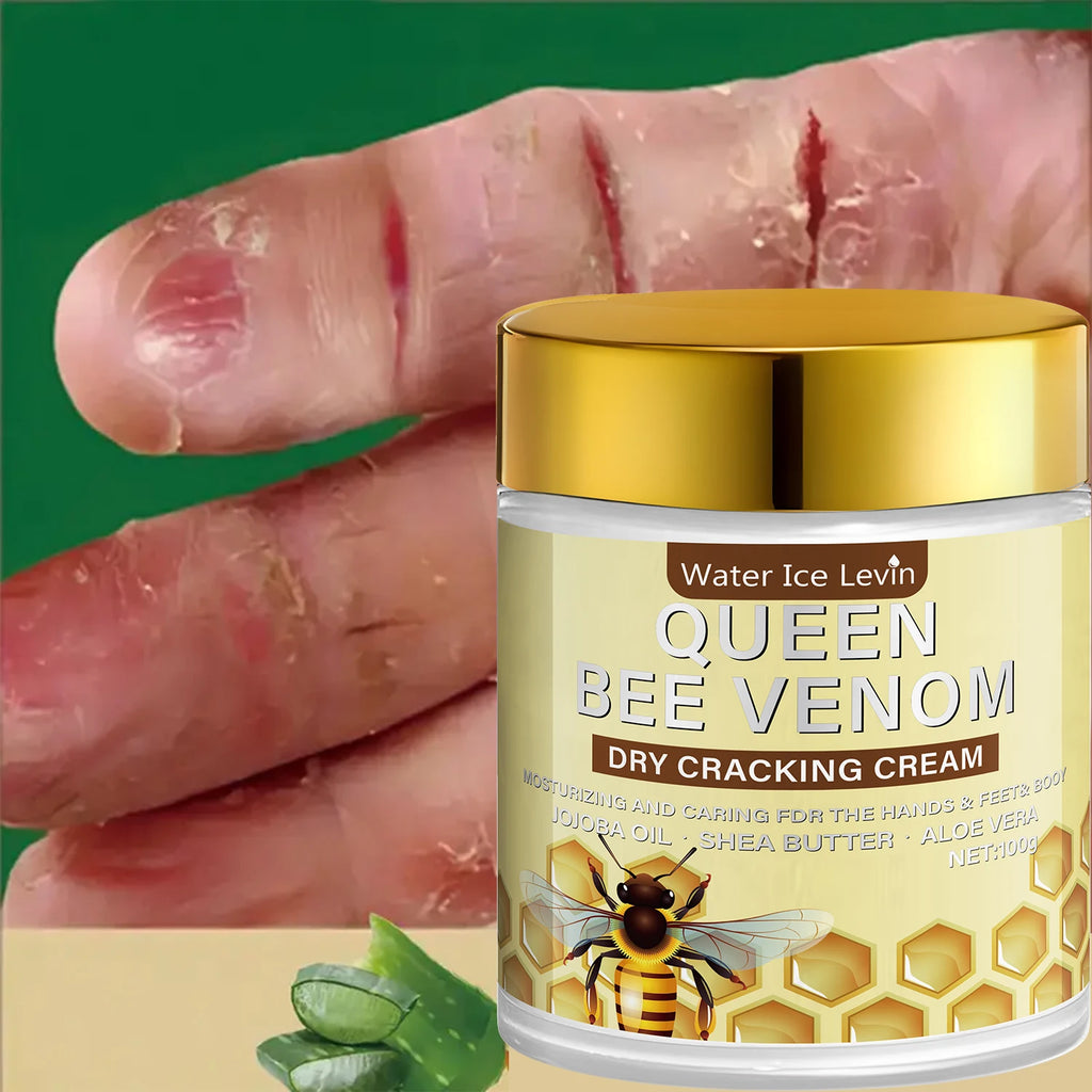 Queen Bee Venom Dry Cracking Cream with Retinol & Niacinamide - Intense Moisturizing for Hands, Feet & Body. Repairs Dry Skin. Qme