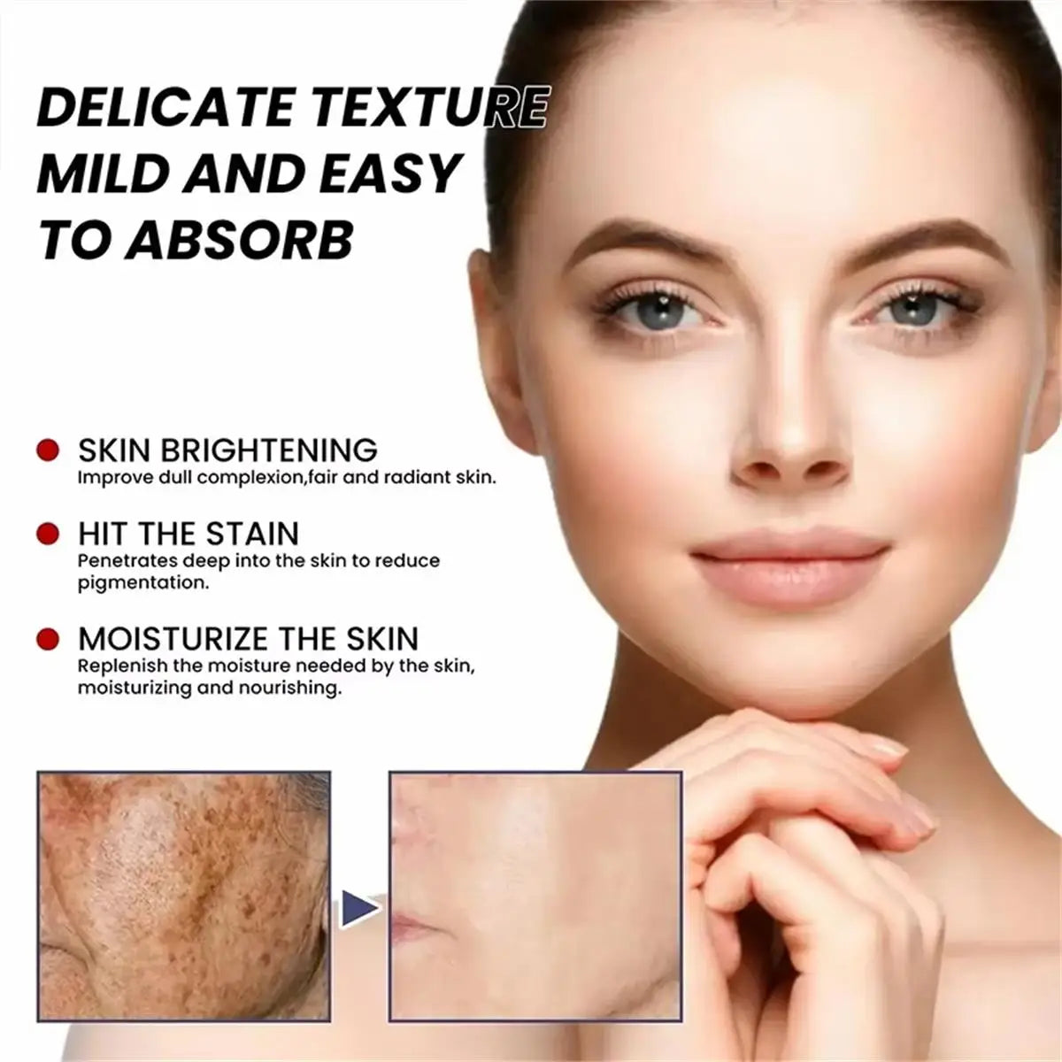 Whitening Freckle Cream Remove Dark Spots Anti Freckle Face Creams Niacinamide Fade Pigmentation Melasma Brighten Skin Care 20g Qme