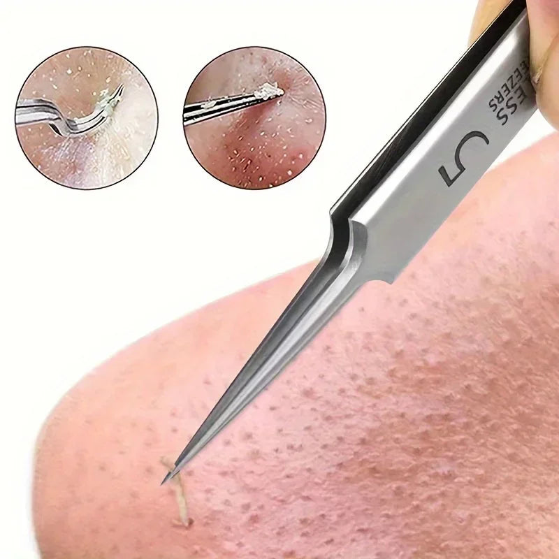 Professional Extra Fine No 5 Cellular Acne Blackhead Tweezers Facial Qme