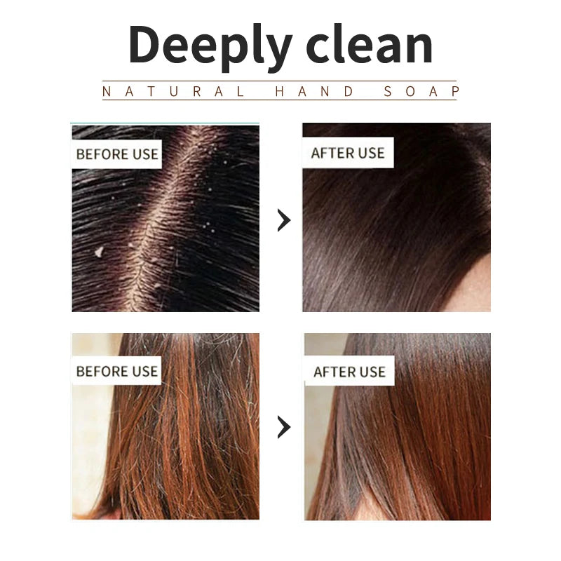 Lemon Plant Shampoo Refreshing Oil Controlling Dandruff Reducing Qme