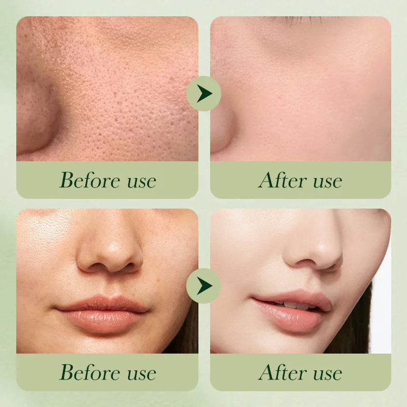 Avocado Skincare 6-Piece Includes Nourishing Moisturizing Eye Cream Qme