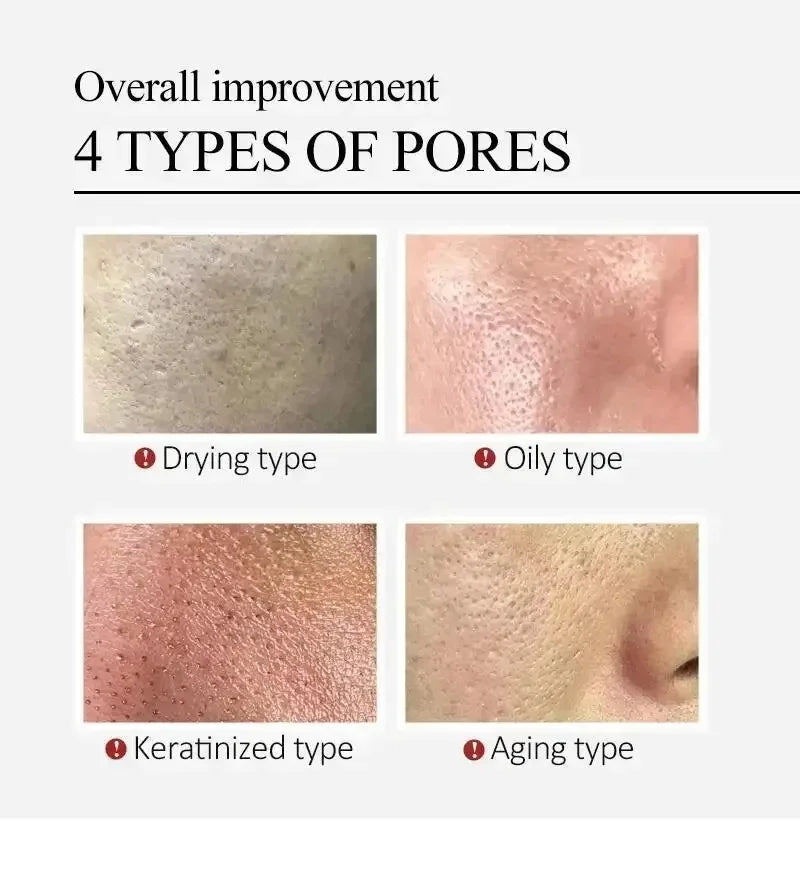 Clean Pores Serum Facial Delicate Tender Moisturizing Oil Control Shrink Pores Rough Skin Smooth Care Brighten Korean Cosmetics Qme