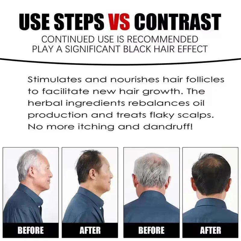 Herbal Anti-grey Treatment Hair Dye Shampoo White To Black Permanent Repair Natural Color Nourish Scalp Hair Care Products Qme