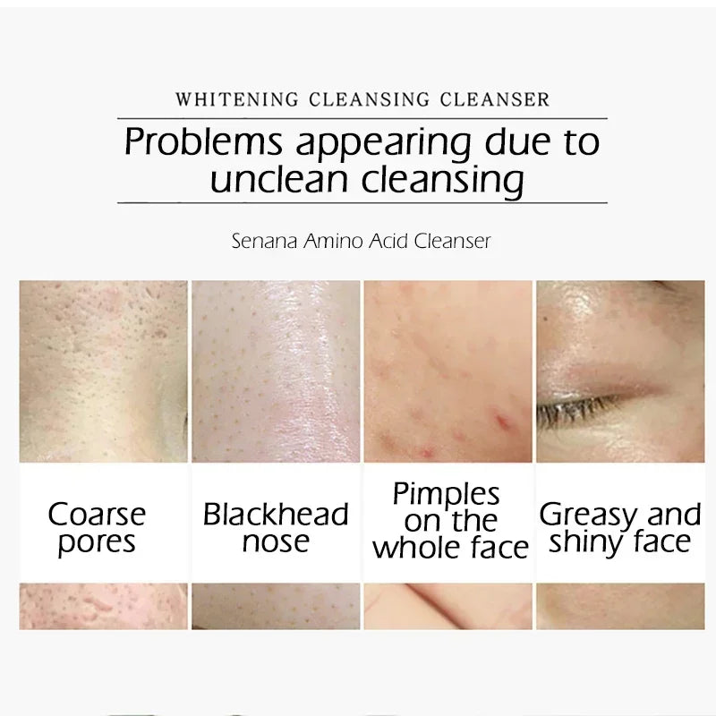 Nicotinamide Amino Acid Face Cleanser Facial Scrub Cleansing Acne Oil Control Blackhead Remover Shrink Pores Skin Care Qme