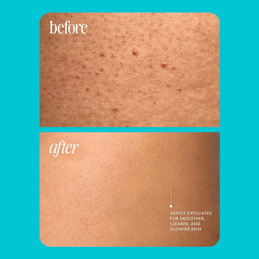 GZE PRE SHAVE SCRUB Exfoliator for Bikini Area - Ingrown Hair Body Scrub - Bikini Exfoliating Scrub Qme