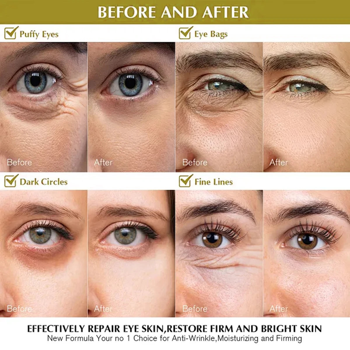 EXE CREAM 010 Eye Cream with Retinol & Hyaluronic Acid - Moisturizing, Smoothing & Protective Anti-Aging Eye Treatment Qme