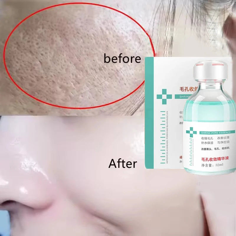 Remove Large Pores Serum Lactic Acid Facial Pore Shrinking Repairing Qme