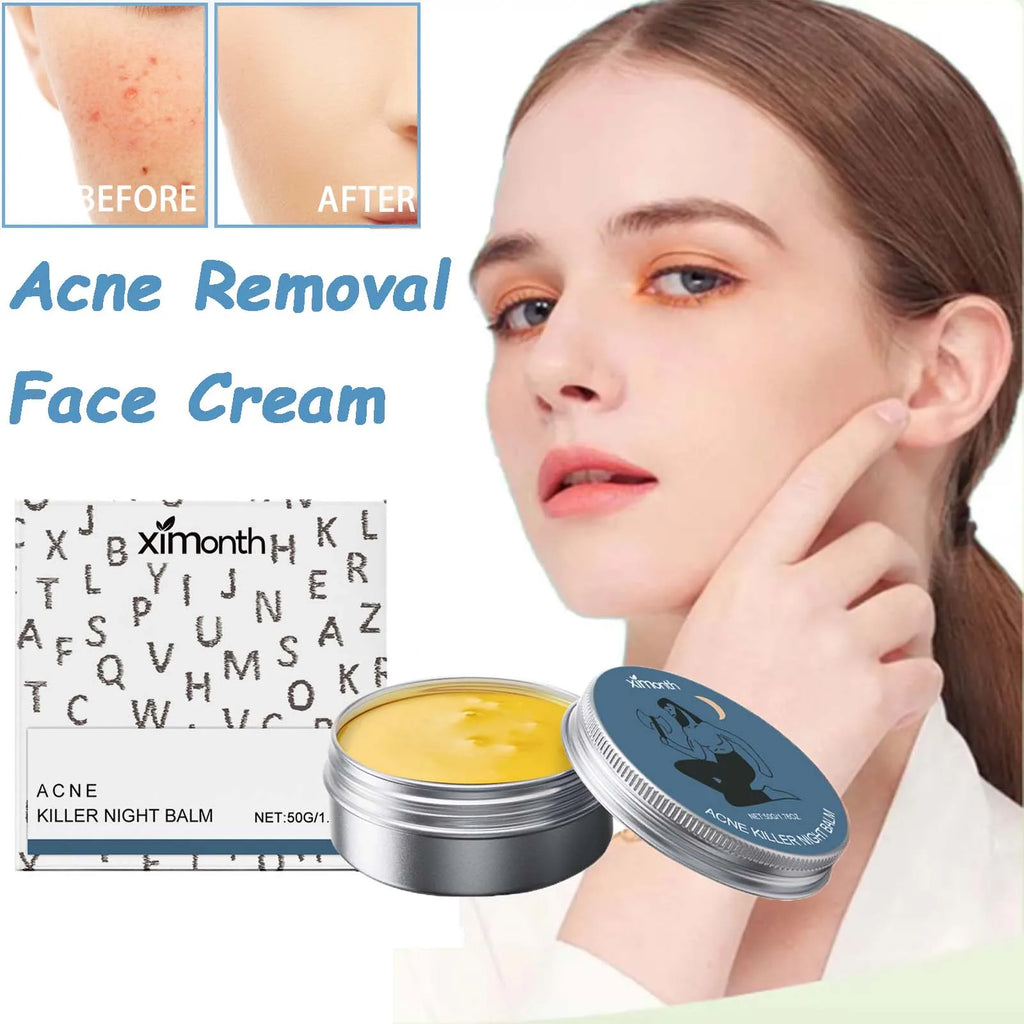 Acne Removal Face Cream Gently Balances Skin Oil Refreshing Skin Care Shrink Pores Oil Control Hydrating Anti Acne Cream Qme
