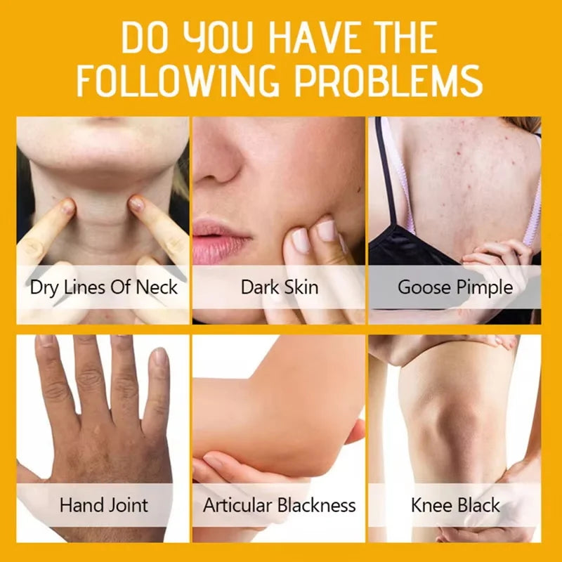 Strong Yellow Peeling Oil Bleach Dark Skin Whiten Lotion Lighten Body Elbow Knee Hand Exfoliate Dead Skin Nourish Even Skin Tone Qme