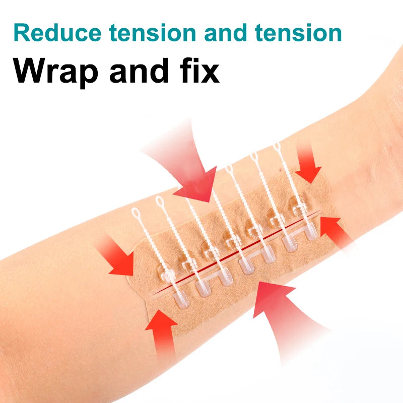 Zipper Tie Wound Closure Patch Hemostatic Fast Without Suture Outdoor Qme