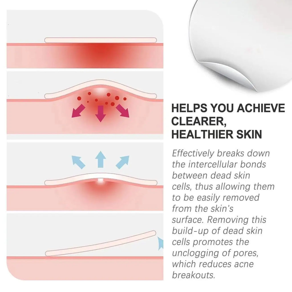 Invisible Acne Patches Removal Pimple Anti-acne Hydrocolloid Spots Qme