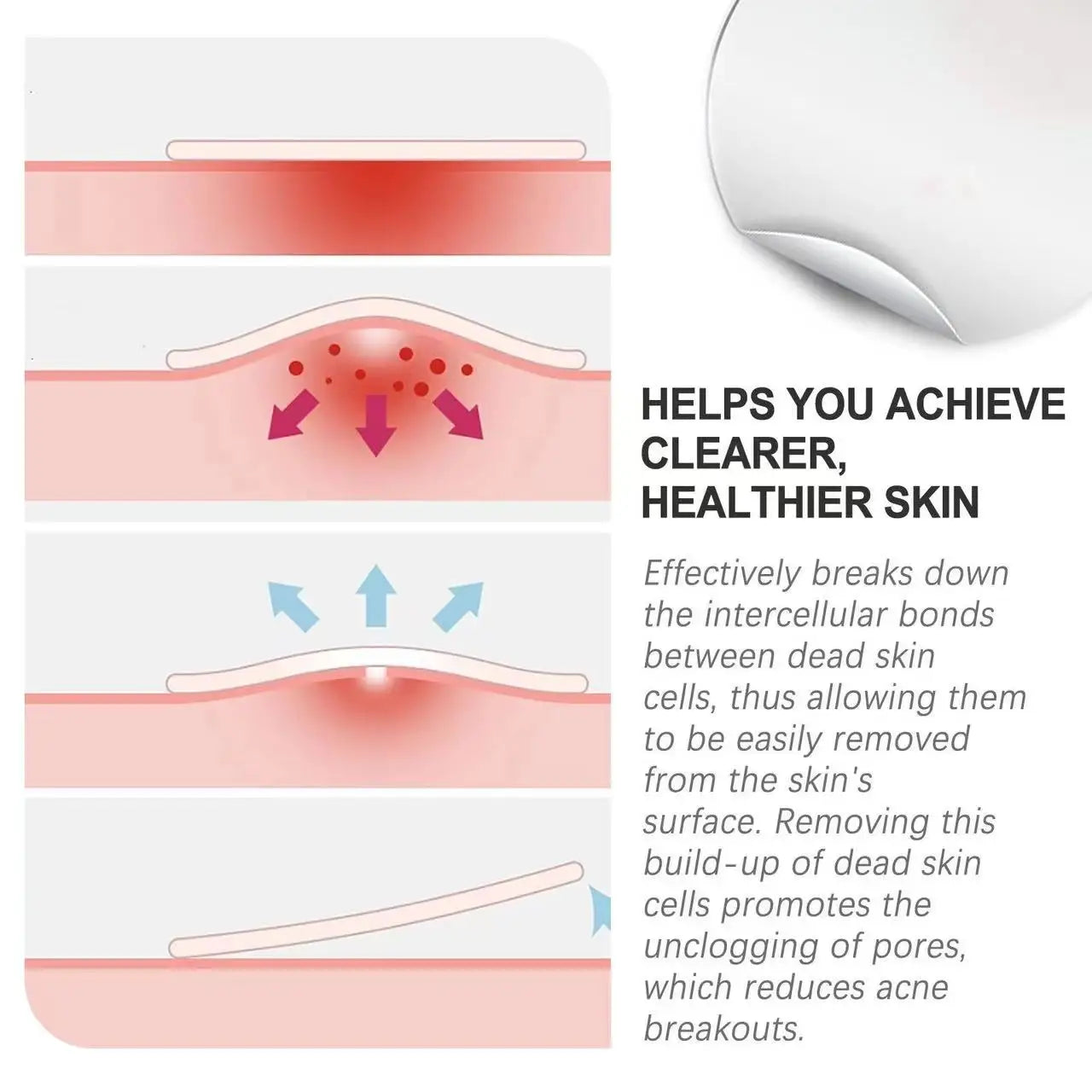 Invisible Acne Patches Removal Pimple Anti-acne Hydrocolloid Spots Qme