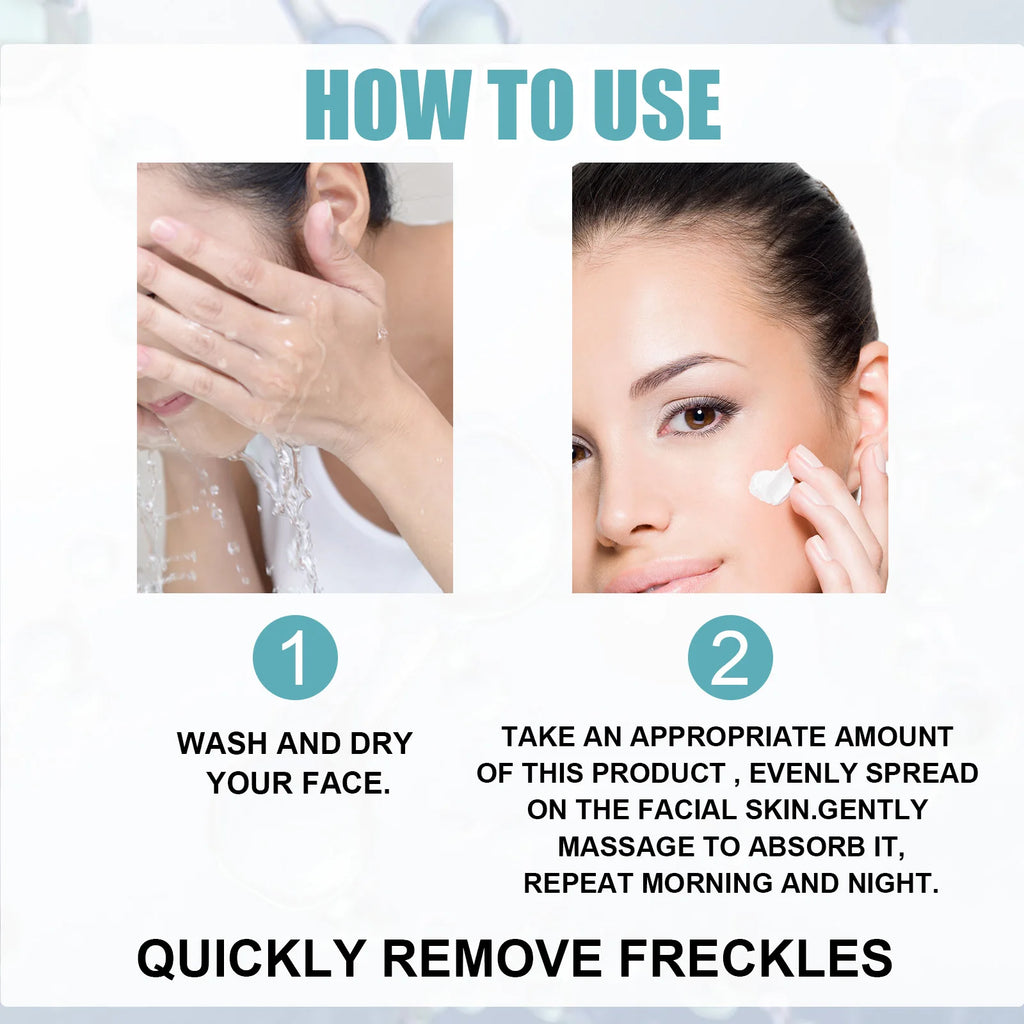 Freckle Whitening Cream Nicotinamide Fade Dark Spot Blemish Acne Mark Brightening Lightening Pigmentation Correction Cream Qme