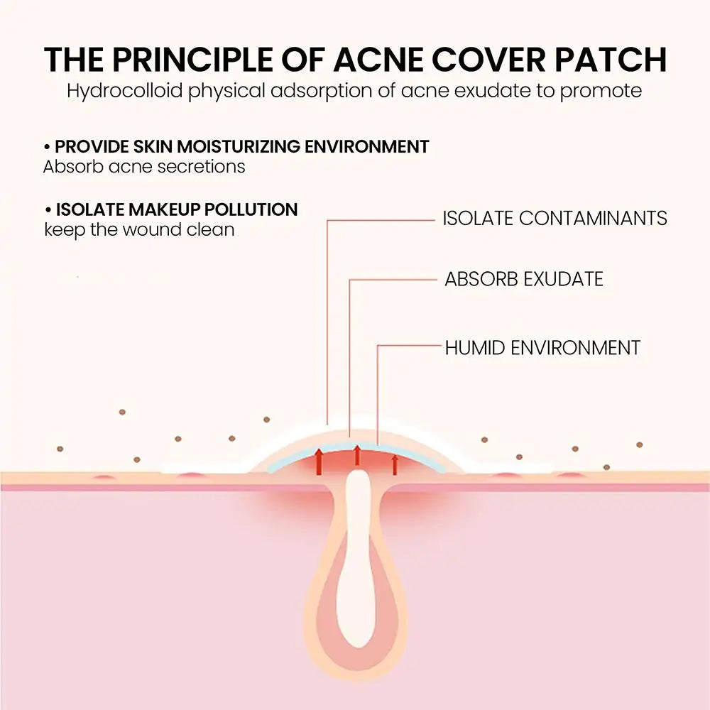 200 Counts Colorful Hydrocolloid Cute Star Shaped Acne Pimple Patch For Face Invisible Zit Cover Stickers Skin Care Qme