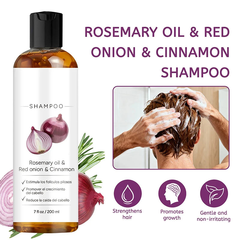Rosemary Red Onion Hair Care Shampoo Balances Oil Dryness Enhances Qme