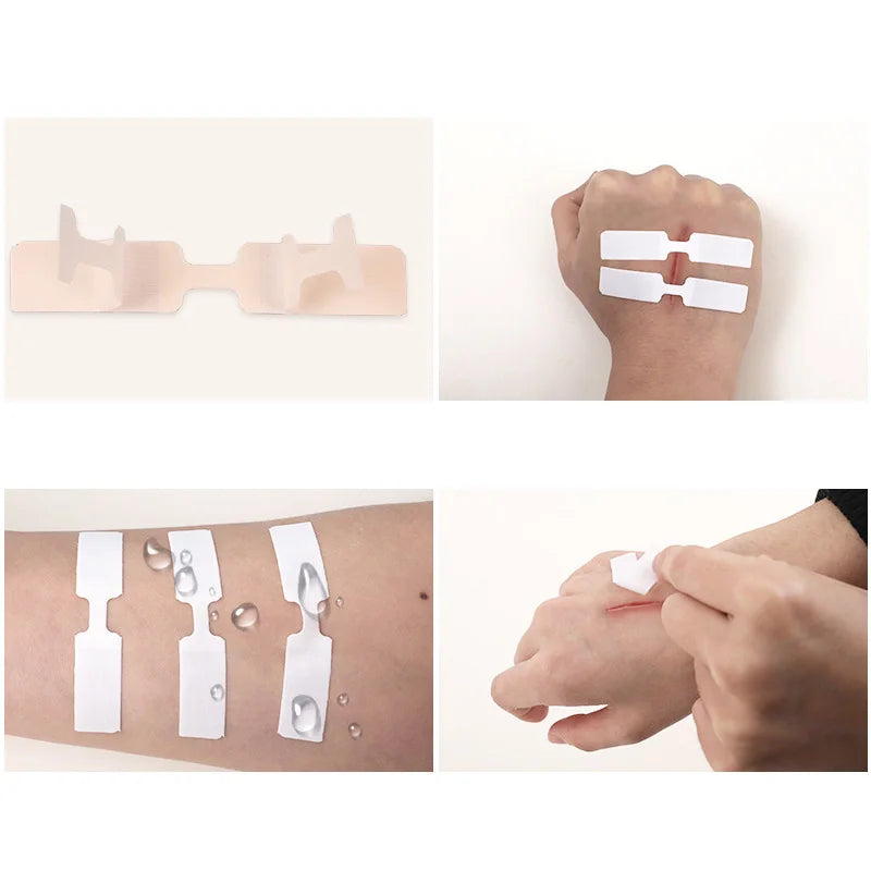 No Seam Band-aid Outdoor Quick Wound Suture Zipper Tape Reduce Qme