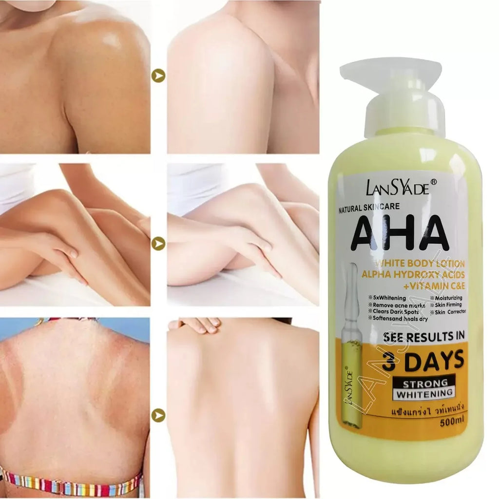 500ml Whitening Body Cream Hydroxy Acids Vitamin C&E Moisturizing Lightening Body Lotion Skin Care Remove Acne Marks Qme