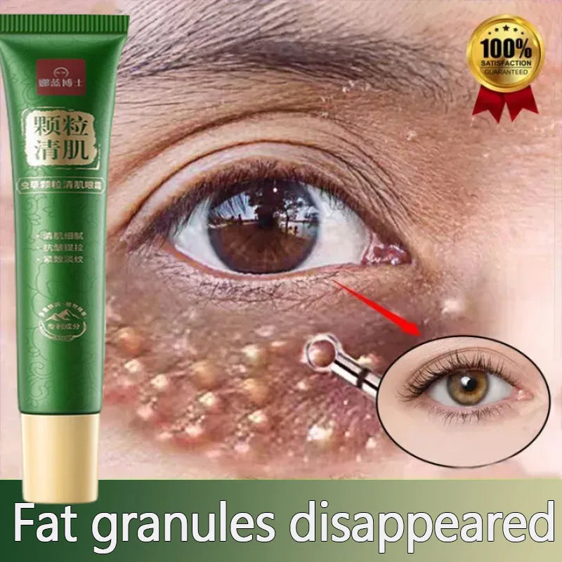 Fat Granules Remover Eye Cream Anti-Puffiness Anti Inflammatory Reduce Dark Circles Eyebags Fade Lines Moisturizing Eye Care Qme