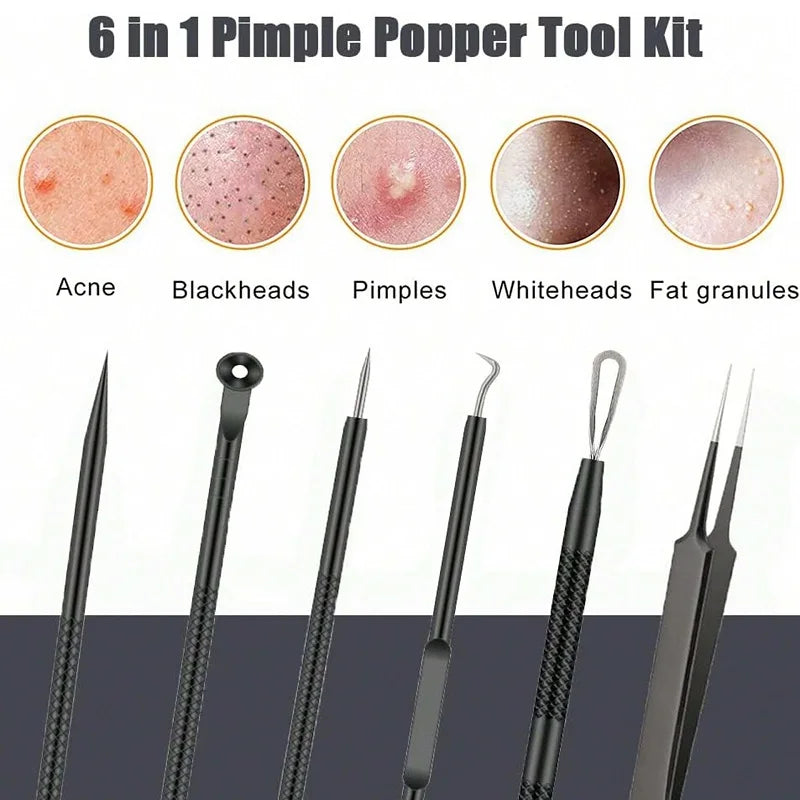 Pimple Popper Tool Blackhead Remover Acne Needle Tools Removing Care Qme
