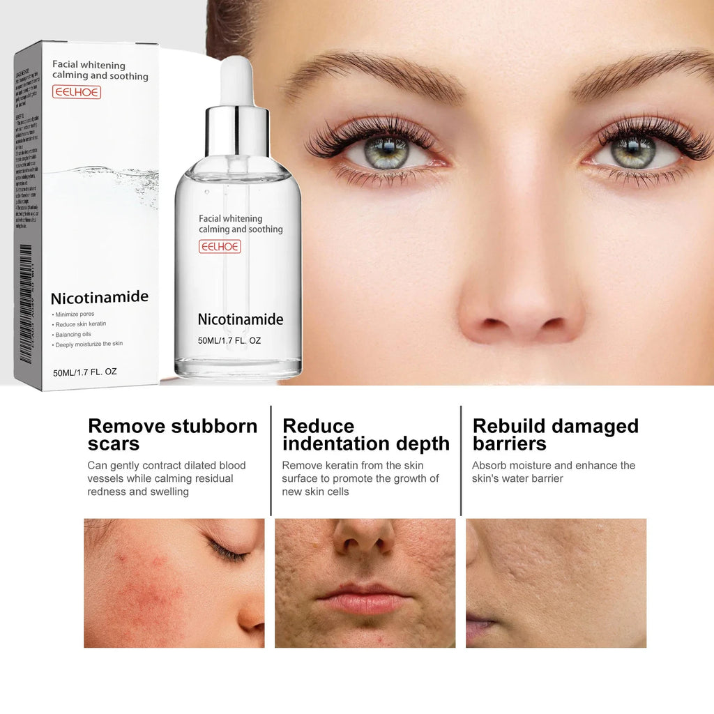 Niacinamide Face Serum Brightening Lighten Dark Spots Acne Marks Fade Blemishes Pigmentation Moisturizing Facial Essence Qme