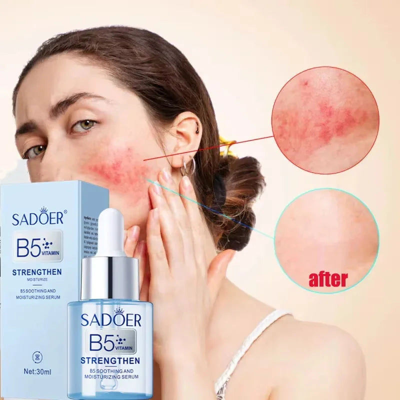 Facial Redness Repair Serum Improve Sensitive Muscles Acne Rosacea Dry&Itchy Skin Moisturizer Lotion Korean Skin Care Products Qme