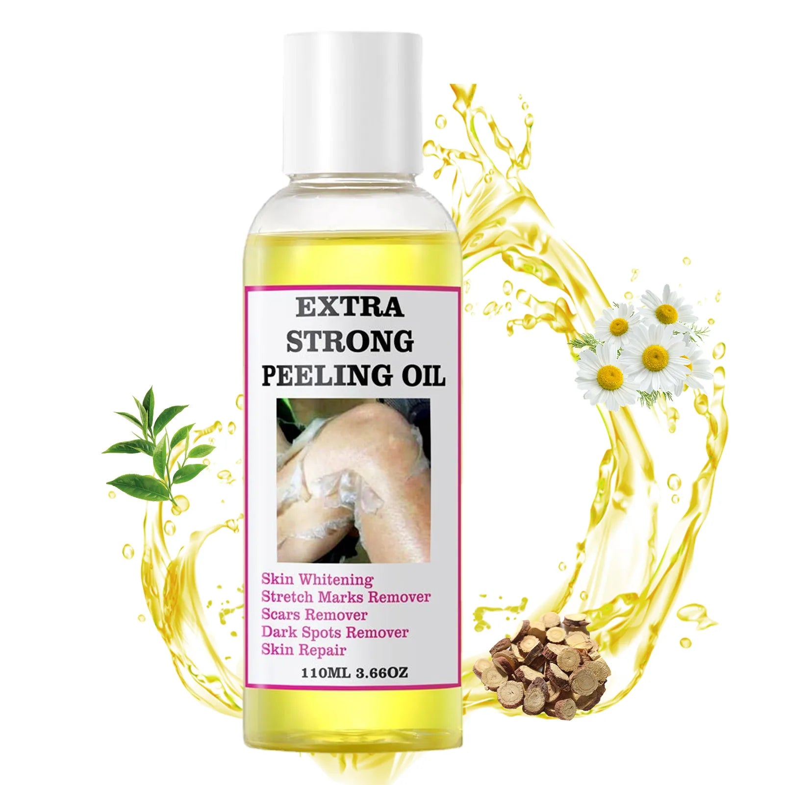 Peeling Oil Yellow Dark Spots Body Thai Hyaluronic Acid Strong Extra Qme