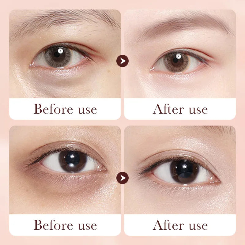 Retinol Eye Cream Remove Dark Circles Eye Bags Puffiness Reduces Wrinkle Eye Serum Stick Dark Circles Removal Man Woman Eye Care Qme