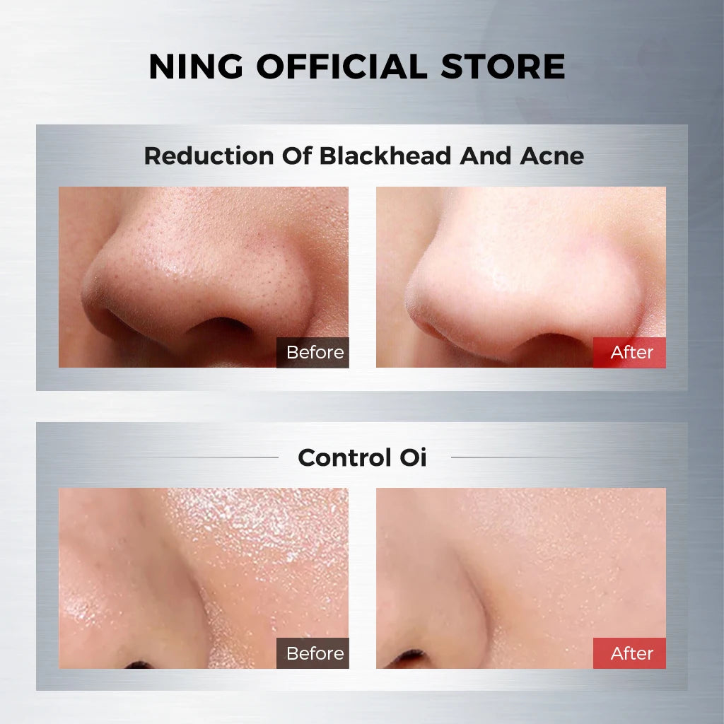 NING Amino Acid Facial Cleanser Gentle Hydrating Deep Cleansing Face Qme