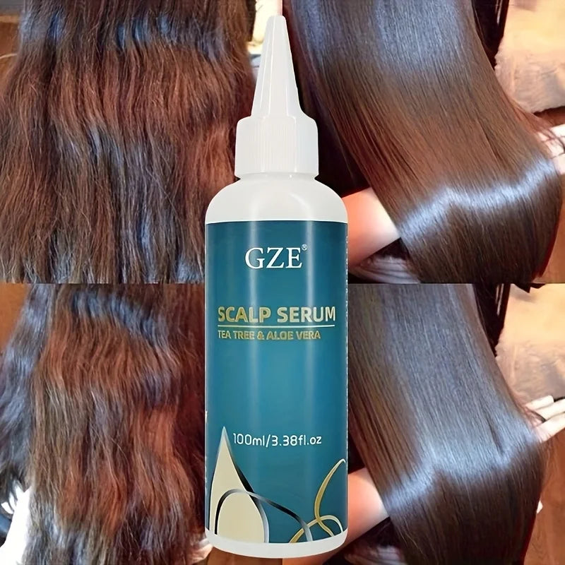 GZE Scalp Serum With Tea Tree & Aloe Vera Leave-In Conditioner Remove loose dandruff flakes For Dry Scalp for Women and Men Qme