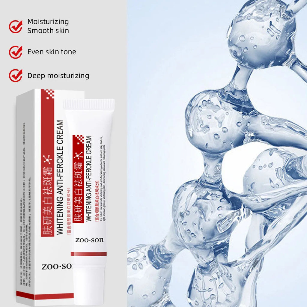 Whitening Freckle Cream Remove Dark Spots Anti Freckle Face Creams Niacinamide Fade Pigmentation Melasma Brighten Skin Care 20g Qme