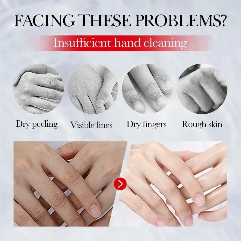 Kojic Acid Anti-wrinkle Hand Cream Skin Soften Nourish Anti-drying Qme