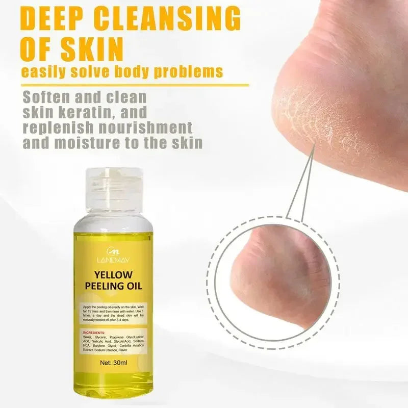 Yellow Peeling Oil Lighten Elbows Knees Hands Melanin Strong Yellow Peeling Oil Even Skin Tone And Whiten Skin Care Supplies Qme