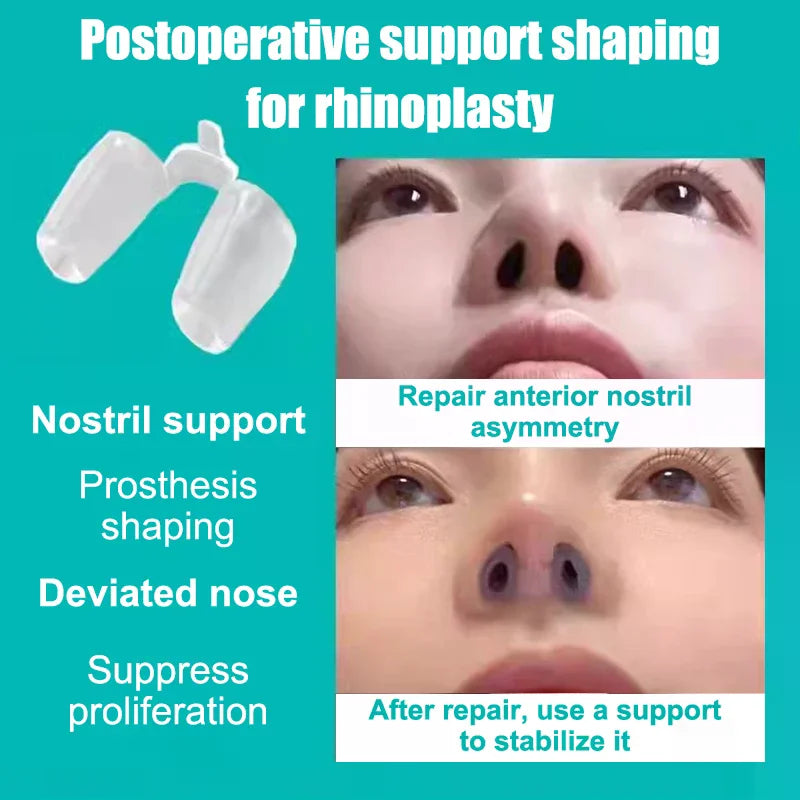 Postoperative Rhinoplasty Nostril Support Silicone Shaping Crooked Qme