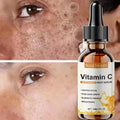 Vitamin C Whitening Serum Remove Freckles Dark Spots Face Essence Fade Melasma Melanin Brighten Repair Dull Skin Care Cosmetics Qme 1pc