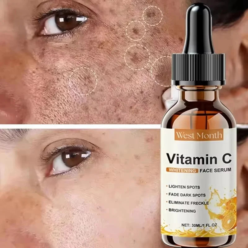 Vitamin C Whitening Serum Remove Freckles Dark Spots Face Essence Fade Melasma Melanin Brighten Repair Dull Skin Care Cosmetics Qme 1pc