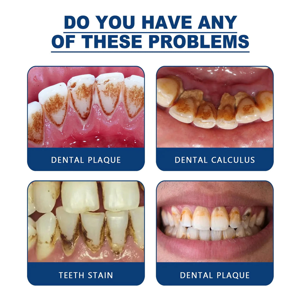 Tooth Whitening Essence Tooth Calculus Removing Dental Plaque Bad Breath Yellow Teeth Repairing Gums Teeth Cleaning Toothpaste Qme