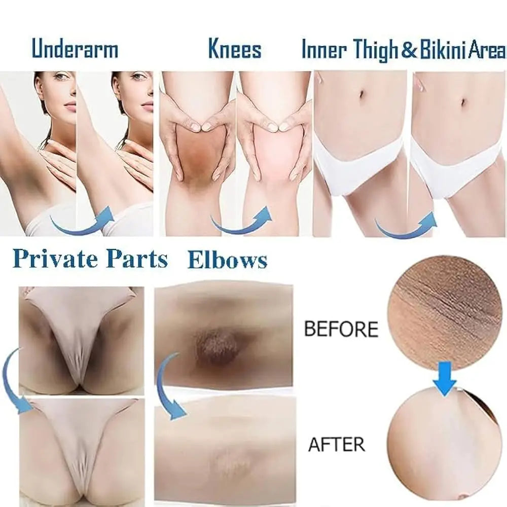 Whitening Cream Private Parts Underarm Bleaching Serum Whiten Butt Knee Brighten Inner Thigh Intimate Parts Dark Remove Melanin Qme