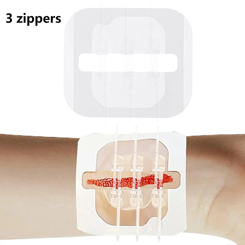 Zipper Tie Wound Closure Patch Hemostatic Fast Suture Band-aid Qme