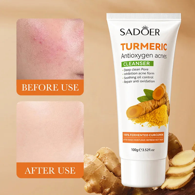 Turmeric Facial Cleanser Antioxidant Acne-removing Pore-cleansing Qme