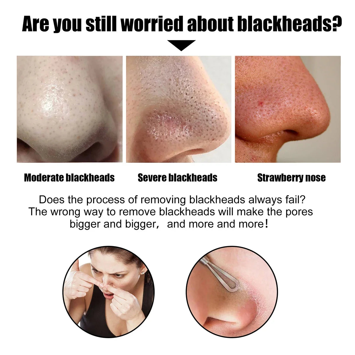 Blackhead Remover Nose Patches 10- Deep Clean Gentle Certified Qme