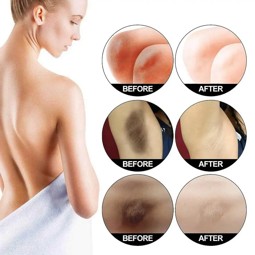Body Whitening Cream Private Parts Underarm Dark Skin Bleaching Serum Niacinamide Whitening Lighten Dark Spots Snow Bleach Cream Qme