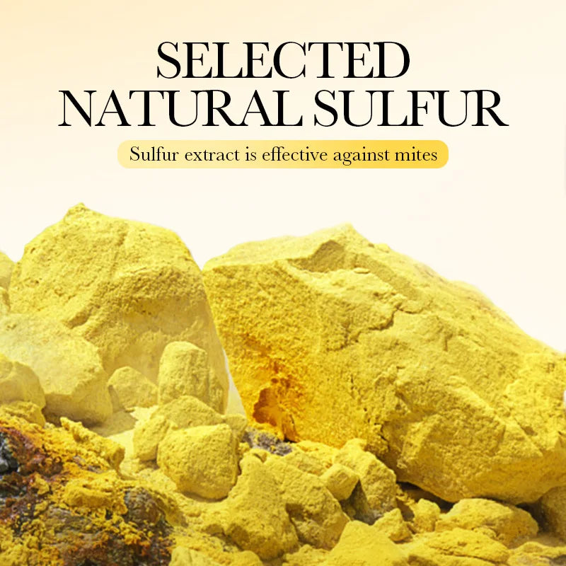 Sulfur Soap Gently Cleanses Removes Dirt Providing Deep Cleaning Qme