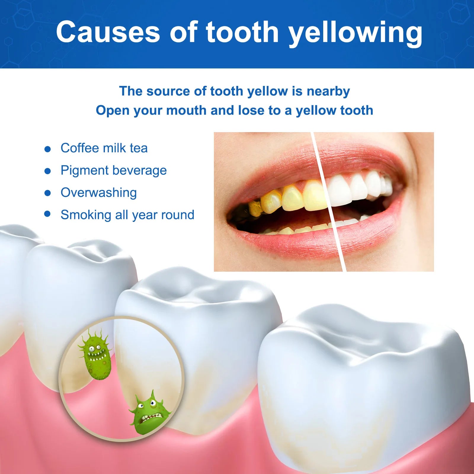 SP Probiotic Toothpaste Whiten Toothpaste Clean Mouth Stain Remove Fresh Breath Soft Foam Protect Gum Whiten Teeth Oral Care Qme
