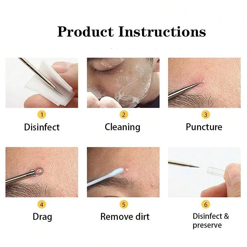 Pimple Popper Tool Blackhead Remover Acne Needle Tools Removing Care Qme