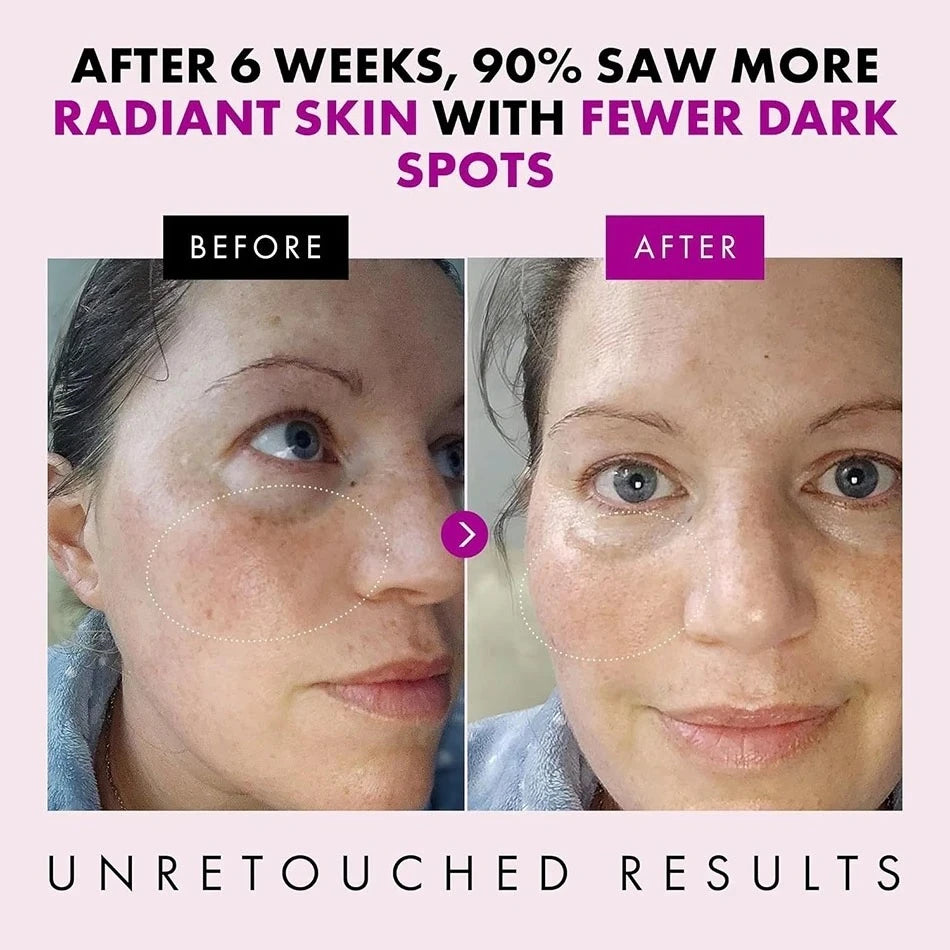 Collagen Anti Aging Face Cream Peptide Complex Facial Wrinkle Day Qme