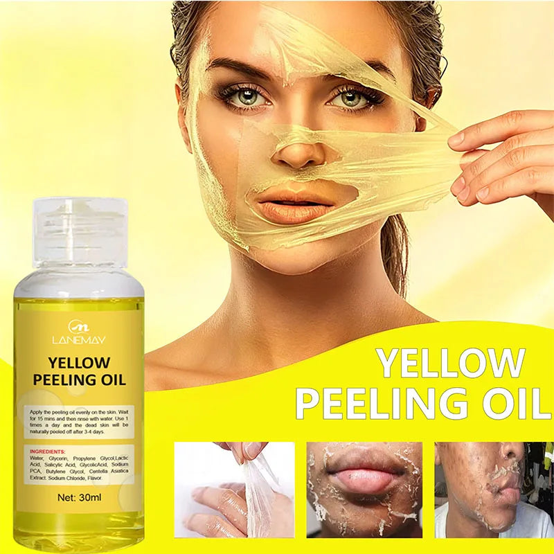 Strong Yellow Peeling Oil Bleach Dark Skin Whiten Lotion Lighten Body Elbow Knee Hand Exfoliate Dead Skin Nourish Even Skin Tone Qme