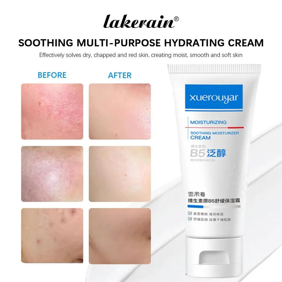 B5 Faded Facial Redness Cream Instant Spider Vein Remove Sensitive Skin Sooth Anti Redness Rosacea Treat Lotion Korean Cosmetic Qme
