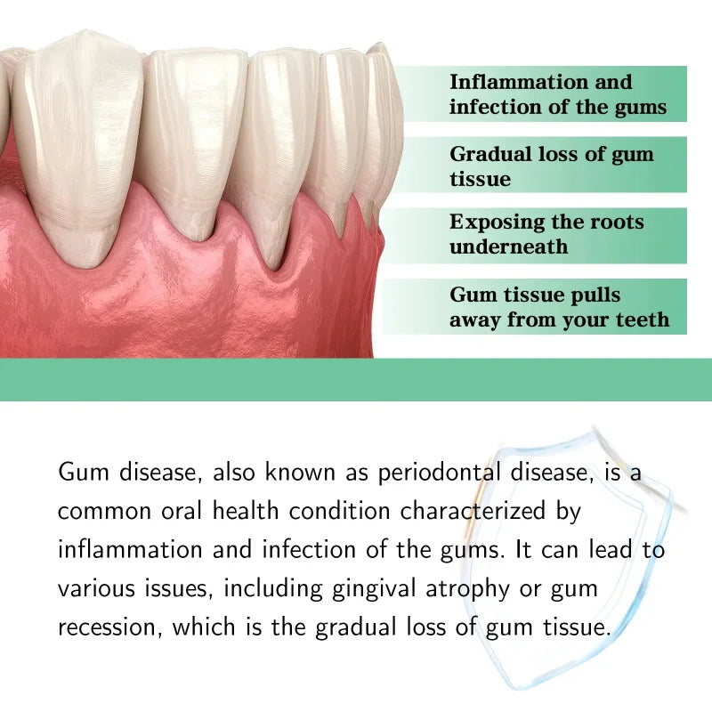 Damaged Gum Repair Care Gel Relieve Sore Gums Allergy Deep Cleaning Teeth Stains Tartar Serum Dental Caries Toothpaste Qme