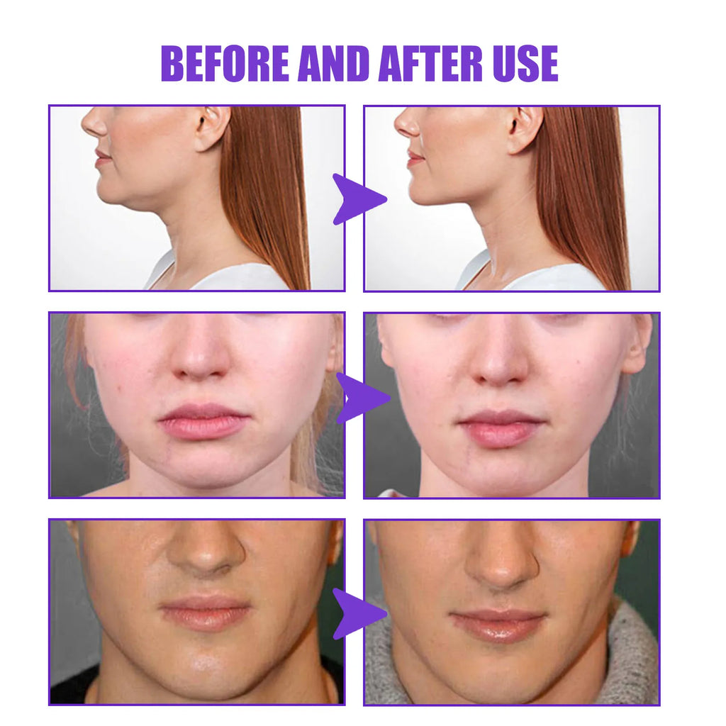 V-Shape Slimming Cream Tighten Mandibular Line Double Chin Lift Firming Face Fat Burning Massage V Face Cream Facial Skin Care Qme